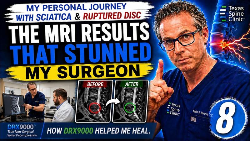 Video: before-and-after MRI of the doctor's own L4-L5 disc.