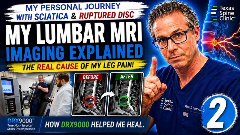 Video: Dr. Barton reviewing his own MRI on screen.