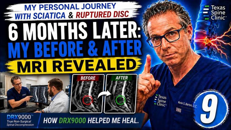 Video: the doctor's own DRX9000 spinal decompression experience.