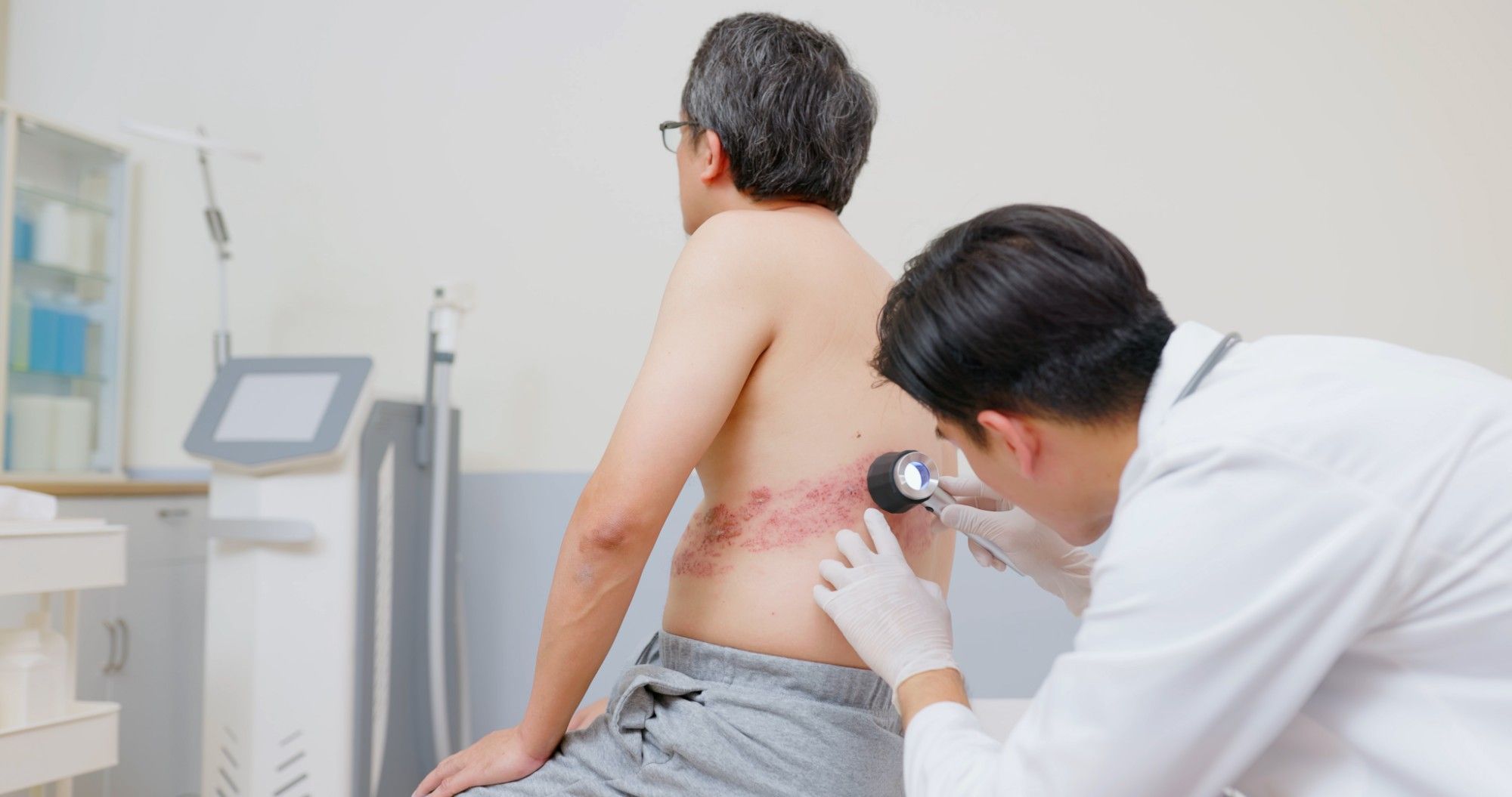 A doctor examining a shingles rash that wraps around a patient's lower back.