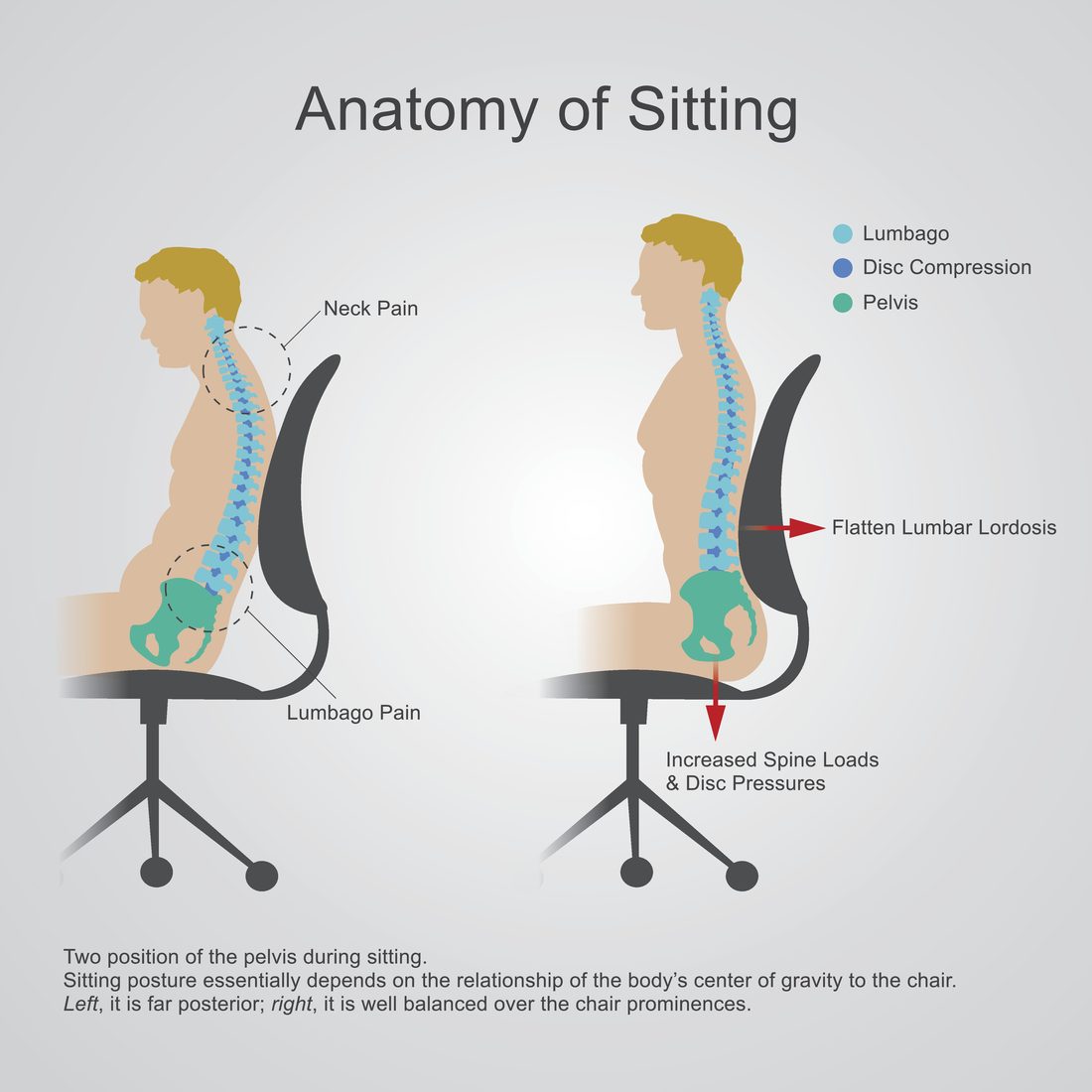 Illustration: two seated postures compared — slumped, with the pelvis rolled back and the lumbar curve flattened, versus upright and balanced over the chair.