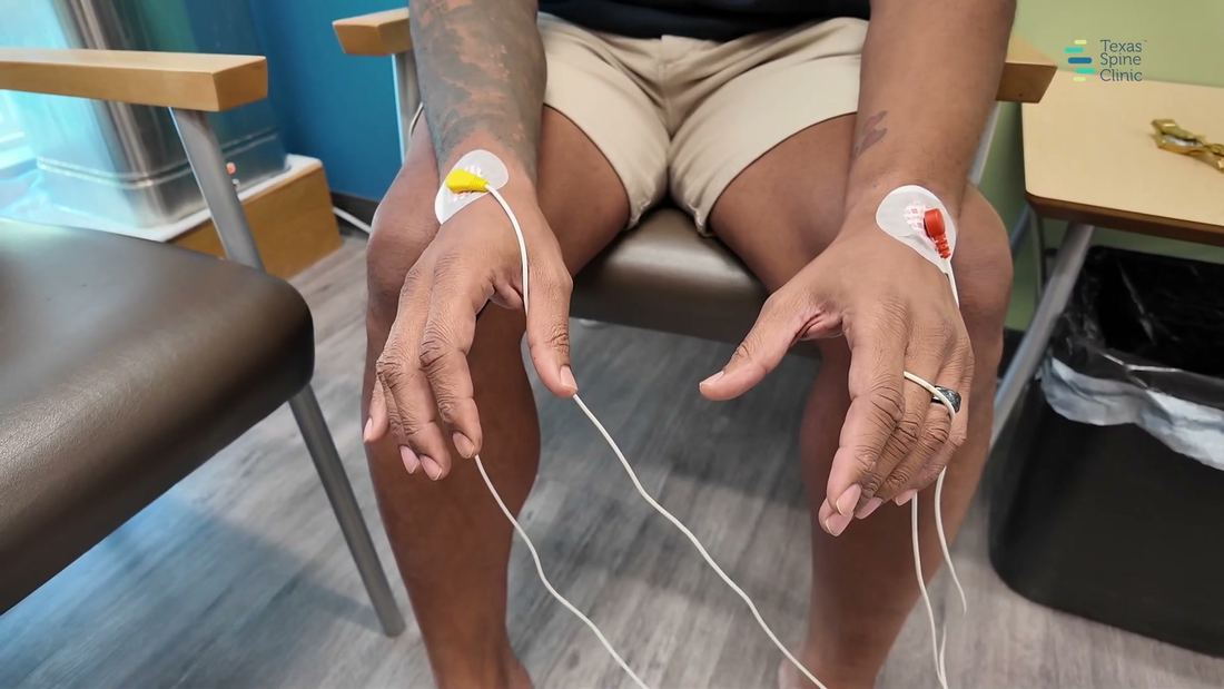 A patient's hands resting on a table with small scrambler therapy electrodes placed on the skin — no needles.
