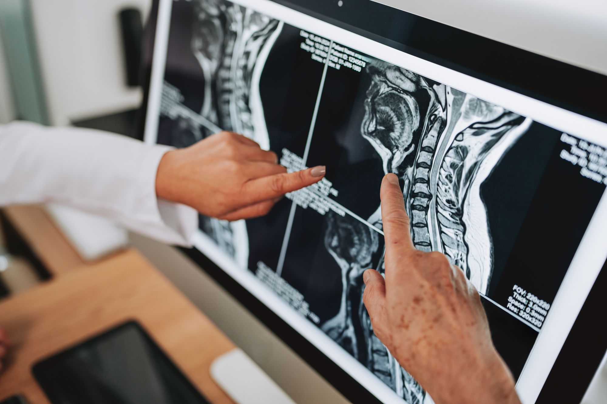 Two people pointing at a spinal MRI on a monitor, going through the scan together.