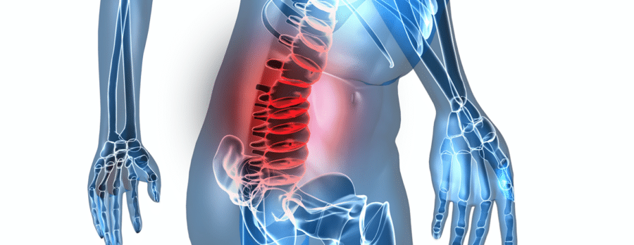 Back pain skeleton